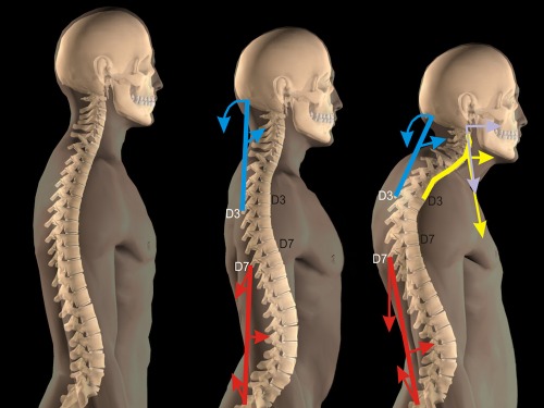 Waist and Neck Straightening
